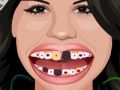 Game Selena Gomez Perfect Teeth 