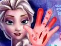 Jeu Frozen. Hand surgery