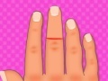 Jeu Finger surgery