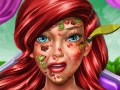 Game Princess Mermaid Skin Doctor