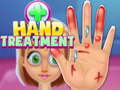 Game Hand Treatment